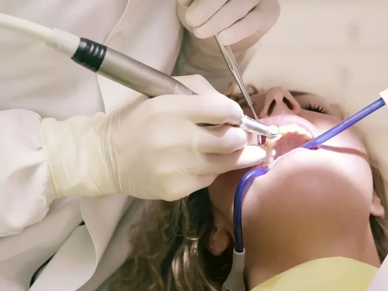 Beneficios de la limpieza dental profesional (y cada cuánto hacerla)